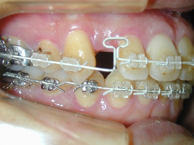 院長Blog｜常滑市の矯正歯科 歯科/久野歯科医院 成人矯正等に対応